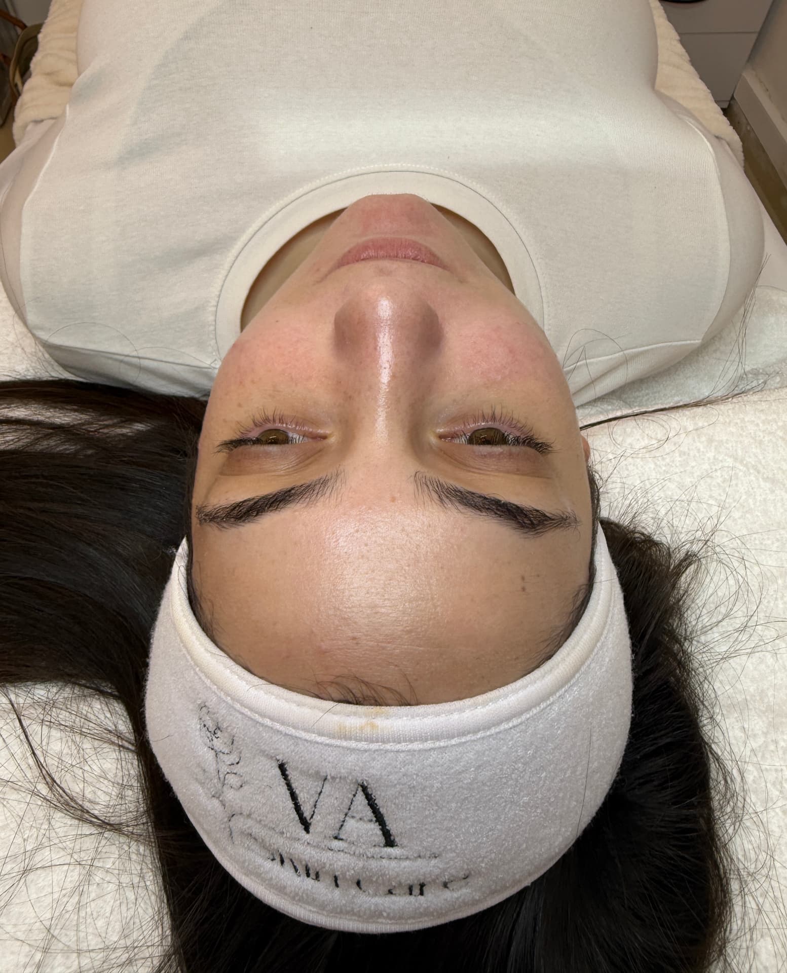 מטופלת בקליניקה עם סרט לבן בעיצוב VA Skincare